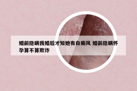 婚前隐瞒我婚后才知她有白癜风 婚前隐瞒怀孕算不算欺诈