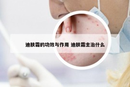 迪肤霜的功效与作用 迪肤霜主治什么