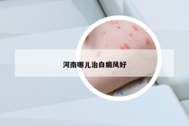 河南哪儿治白癜风好