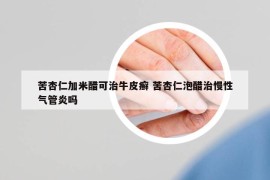 苦杏仁加米醋可治牛皮癣 苦杏仁泡醋治慢性气管炎吗