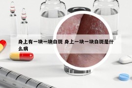 身上有一块一块白斑 身上一块一块白斑是什么病