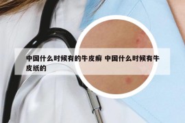 中国什么时候有的牛皮癣 中国什么时候有牛皮纸的