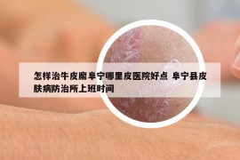 怎样治牛皮廨阜宁哪里皮医院好点 阜宁县皮肤病防治所上班时间