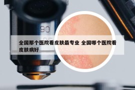 全国那个医院看皮肤最专业 全国哪个医院看皮肤病好