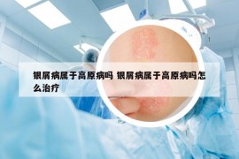 银屑病属于高原病吗 银屑病属于高原病吗怎么治疗