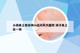 小孩身上有白块in还问天大医院 孩子身上白一块