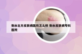 衡水北方皮肤病医院怎么样 衡水皮肤病专科医院