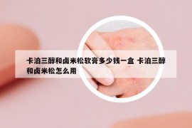 卡泊三醇和卤米松软膏多少钱一盒 卡泊三醇和卤米松怎么用