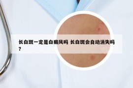 长白斑一定是白癜风吗 长白斑会自动消失吗?