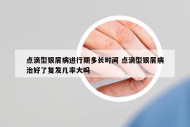 点滴型银屑病进行期多长时间 点滴型银屑病治好了复发几率大吗