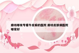 廊坊哪有专看牛皮癣的医院 廊坊皮肤病医院哪家好