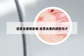 感恩关爱银屑病 感恩关爱的简短句子