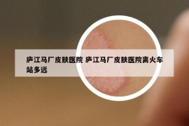 庐江马厂皮肤医院 庐江马厂皮肤医院离火车站多远