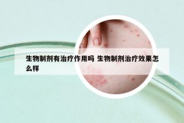 生物制剂有治疗作用吗 生物制剂治疗效果怎么样