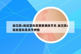 血沉高c反应蛋白高银屑病关节炎 血沉高c反应蛋白高关节肿胀