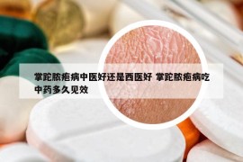 掌跎脓疱病中医好还是西医好 掌跎脓疱病吃中药多久见效