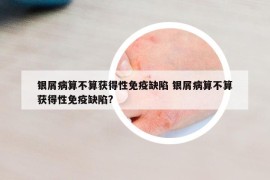 银屑病算不算获得性免疫缺陷 银屑病算不算获得性免疫缺陷?