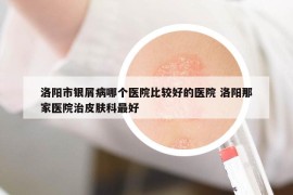 洛阳市银屑病哪个医院比较好的医院 洛阳那家医院治皮肤科最好