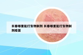 长春哪里能打生物制剂 长春哪里能打生物制剂疫苗