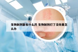 生物制剂都有什么药 生物制剂打了没效果怎么办