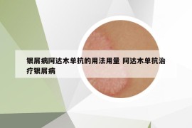 银屑病阿达木单抗的用法用量 阿达木单抗治疗银屑病