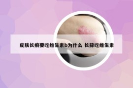 皮肤长癣要吃维生素b为什么 长藓吃维生素