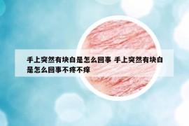 手上突然有块白是怎么回事 手上突然有块白是怎么回事不疼不痒