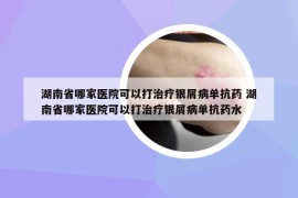 湖南省哪家医院可以打治疗银屑病单抗药 湖南省哪家医院可以打治疗银屑病单抗药水