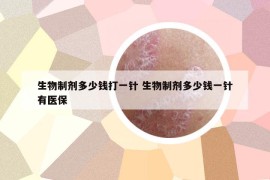 生物制剂多少钱打一针 生物制剂多少钱一针有医保