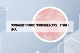 生物制剂针有哪些 生物制剂多少钱一针要打多久