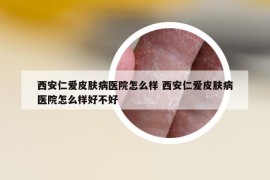 西安仁爱皮肤病医院怎么样 西安仁爱皮肤病医院怎么样好不好