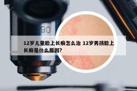 12岁儿童脸上长癣怎么治 12岁男孩脸上长癣是什么原因?