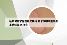 哈尔滨哪家医院看皮肤科 哈尔滨哪家医院看皮肤科好,还便宜