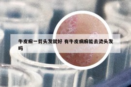 牛皮癣一剪头发就好 有牛皮病癣能去烫头发吗