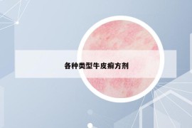 各种类型牛皮癣方剂