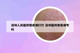 深圳人民医院银屑病打针 深圳医院银屑病专科