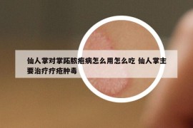 仙人掌对掌跖脓疱病怎么用怎么吃 仙人掌主要治疗疔疮肿毒