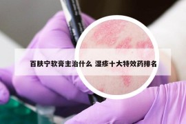 百肤宁软膏主治什么 湿疹十大特效药排名