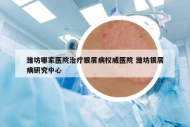 潍坊哪家医院治疗银屑病权威医院 潍坊银屑病研究中心