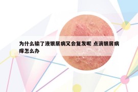 为什么输了液银屑病又会复发呢 点滴银屑病痒怎么办