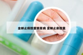 金蝉止痒胶囊银屑病 金蝉止庠胶囊