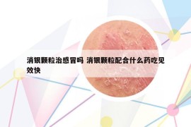 消银颗粒治感冒吗 消银颗粒配合什么药吃见效快