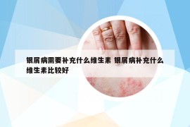 银屑病需要补充什么维生素 银屑病补充什么维生素比较好