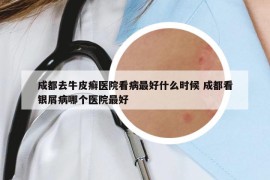 成都去牛皮癣医院看病最好什么时候 成都看银屑病哪个医院最好