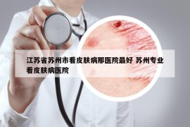 江苏省苏州市看皮肤病那医院最好 苏州专业看皮肤病医院