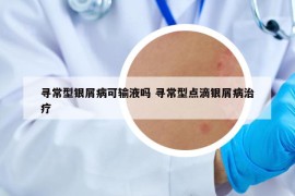 寻常型银屑病可输液吗 寻常型点滴银屑病治疗