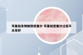 可善挺生物制剂密集针 可善挺密集针过后不太见好