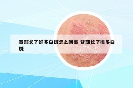 背部长了好多白斑怎么回事 背部长了很多白斑