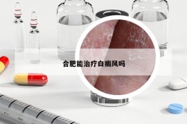 合肥能治疗白癜风吗