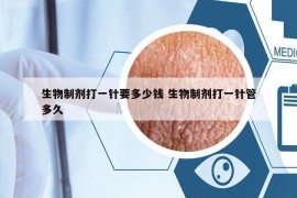 生物制剂打一针要多少钱 生物制剂打一针管多久